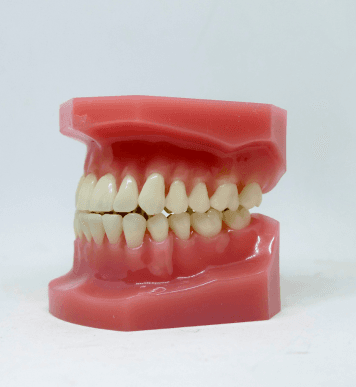 Gum disease, also known as periodontal disease, affects 20% to 50% of older adults (1). A build-up of dental plaque causes an infection on the gums, leading to periodontal disease. …